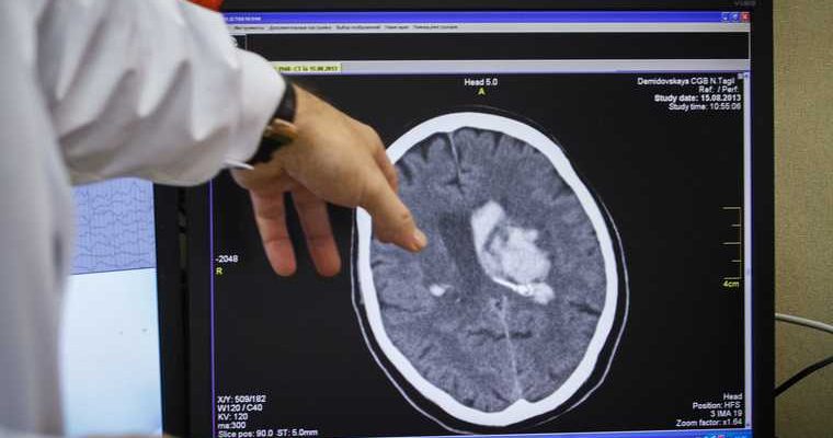 Жанна Фриске