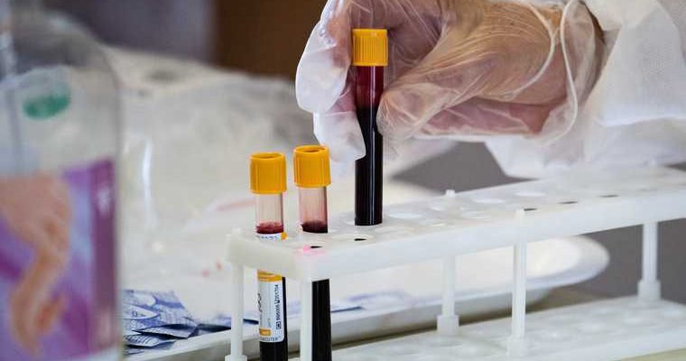 Креков иски лаборатории тесты подробности