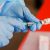 Вирусологи РФ начали испытания новой вакцины от коронавируса