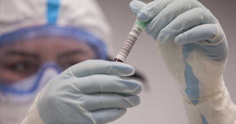 Екатеринбург первый случай британского коронавируса